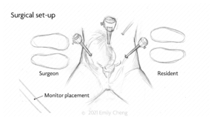 Hysterectomy slides_01_WM_00